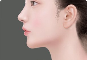 수술과정 4 — 매끈해진 턱·목선의 여성 옆얼굴 일러스트